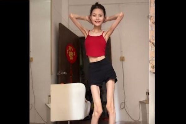 Vídeo: Influenciadora chinesa pesa só 25 quilos e vitalizar com seu corpo magérrimo! Assista - Informa Tudo DF